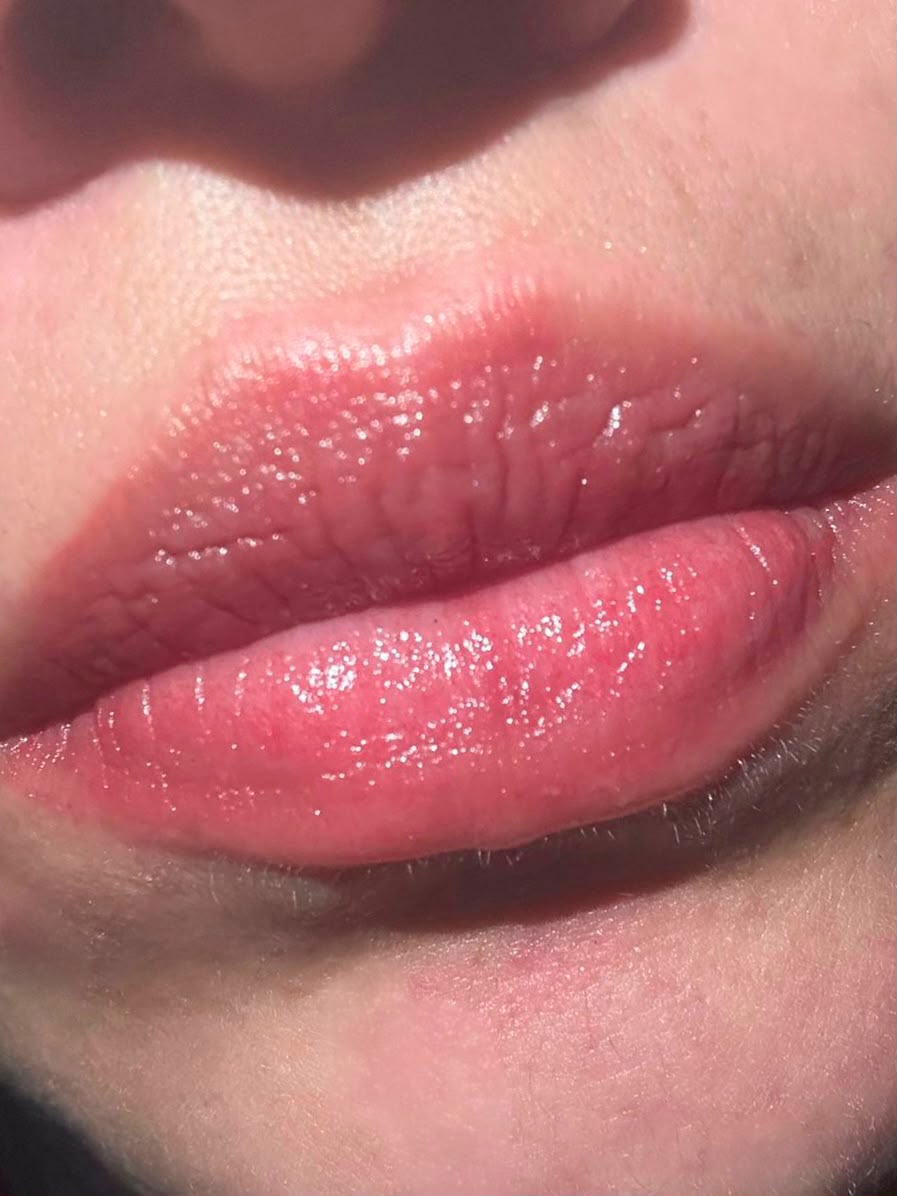 Hidra Lips