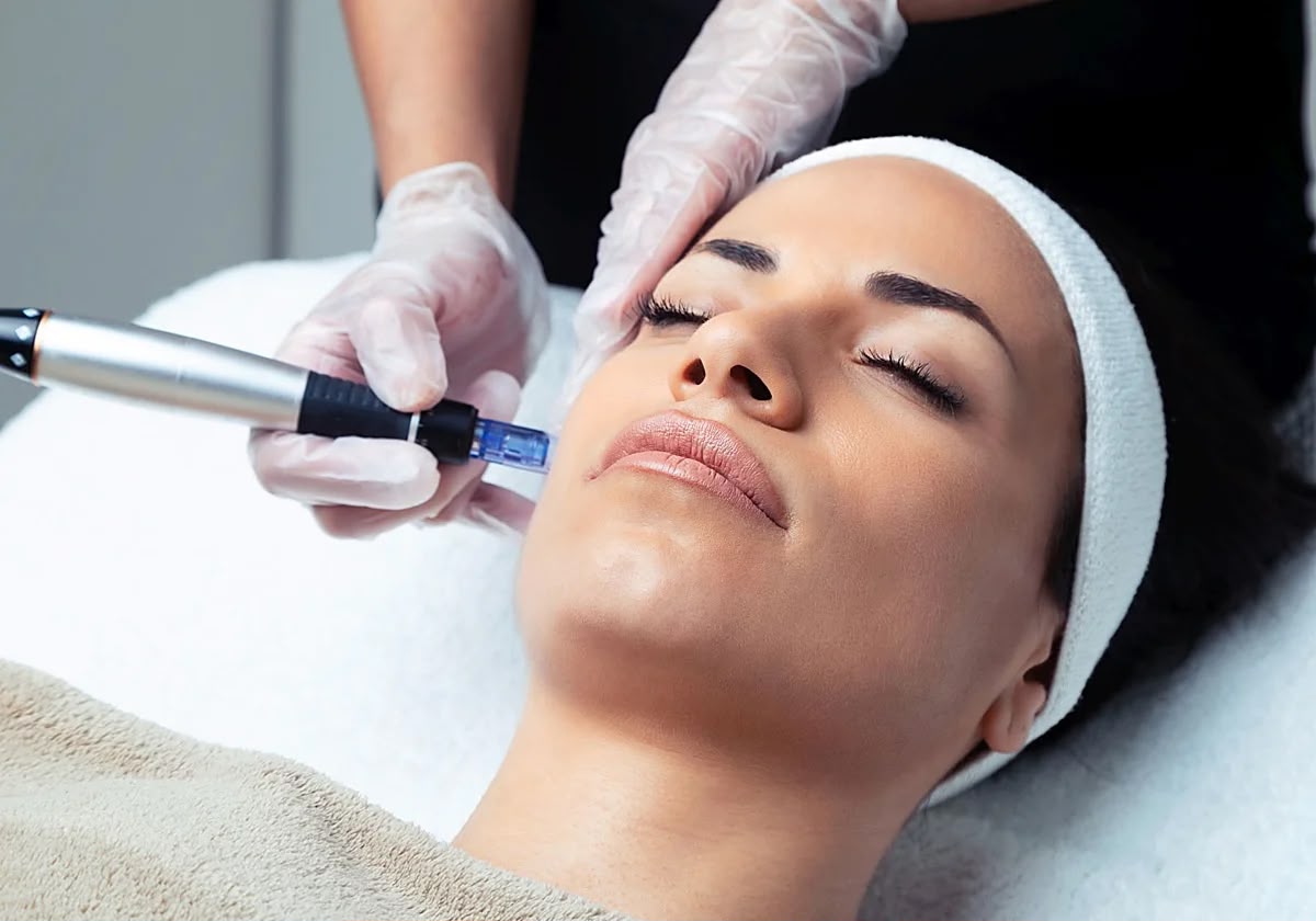 Limpieza facial con Microneedling + BB Glow en Rave